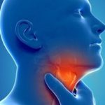 Causas del ardor en la garganta