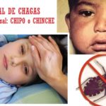 Mal de Chagas en NIÑOS y tratamiento