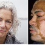 CANAS y las defensas orgánicas