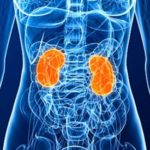 Enfermedades crónicas renales